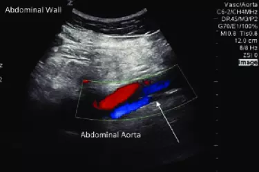 color doppler test of the abdomen in gurgaon