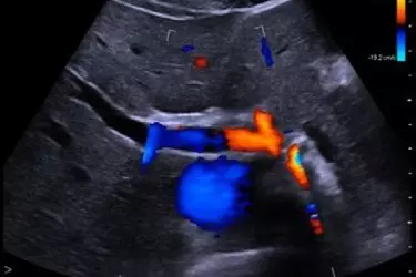 best diagnostic centre for ultrasound in gurgaon