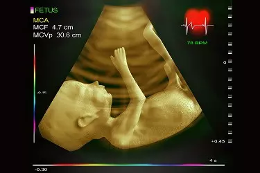 fetal echocardiography test in gurgaon