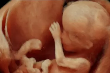 best centre for pregnancy color doppler in gurgaon