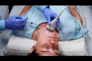 fine needle aspiration cytology to diagnose the nature of a lump